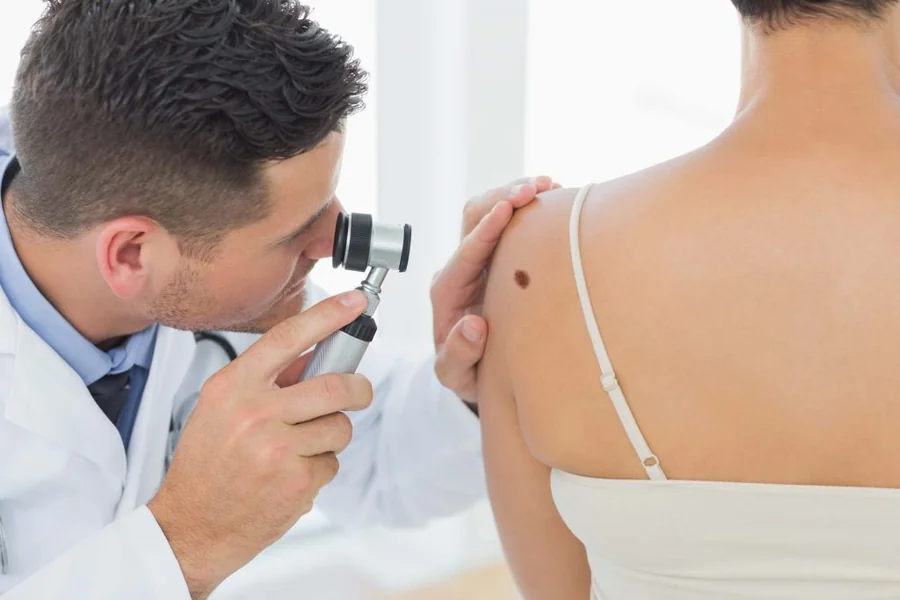Skin Cancer